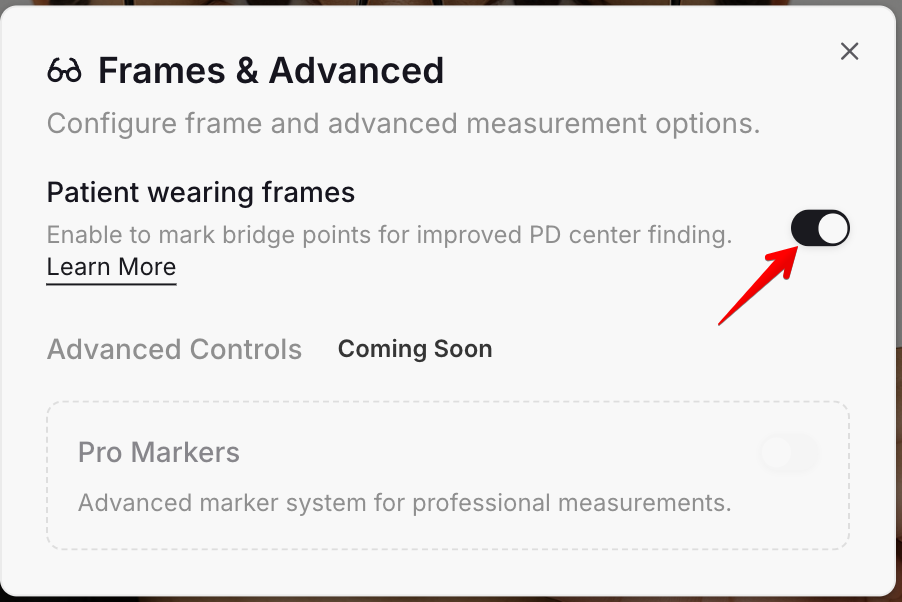 Patient is wearing frames